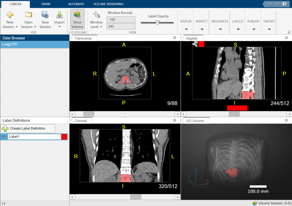 Náhled aplikace Medical Image Labeler, která je součástí Medical imaging Toolboxu